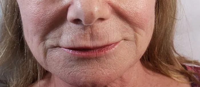 Artistry Aesthetics Picture 3