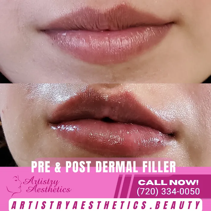 Artistry Aesthetics Picture 8