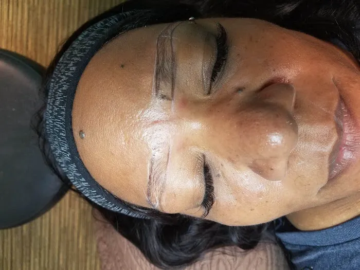 Black Diamond Skin Care Picture 9