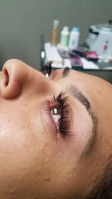 Black Diamond Skin Care Picture 6