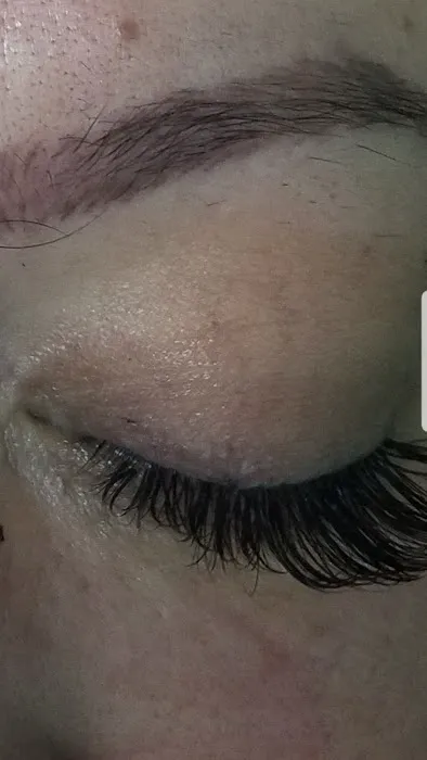 Black Diamond Skin Care Picture 3