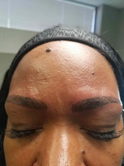 Black Diamond Skin Care Picture 7