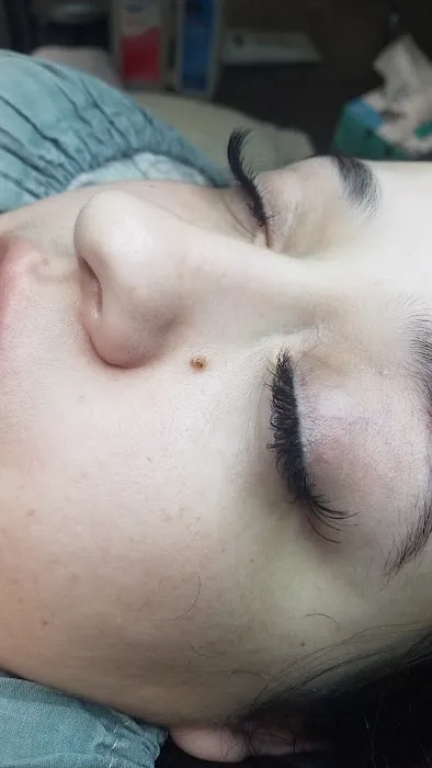 Black Diamond Skin Care Picture 10