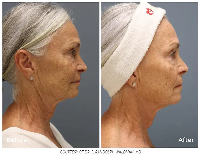 The Glo Alchemist Picture 8