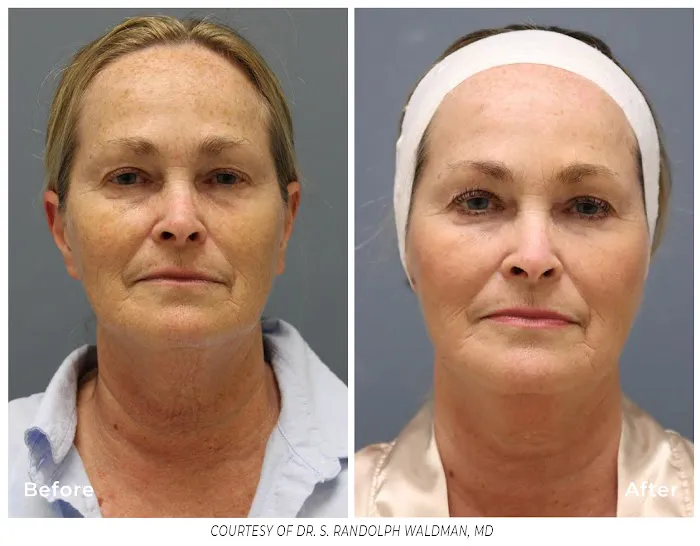 The Glo Alchemist Picture 5