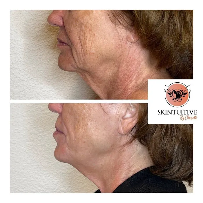 Skintuitive by Chazette Picture 3