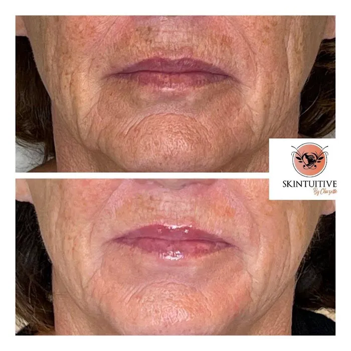 Skintuitive by Chazette Picture 4