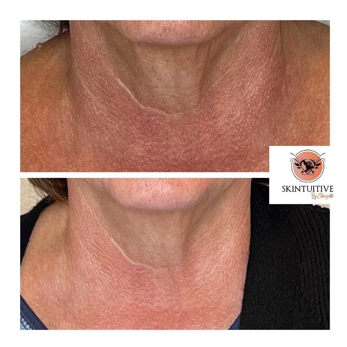 Skintuitive by Chazette Picture 5