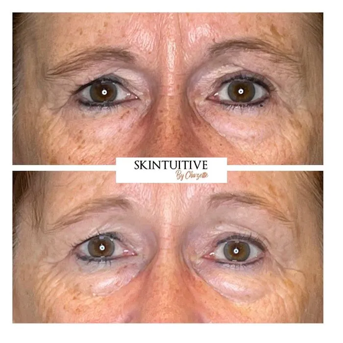 Skintuitive by Chazette Picture 8