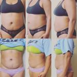 Beauty Unleashed MedSpa