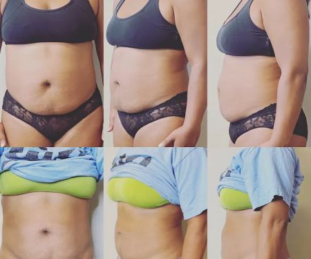 Beauty Unleashed MedSpa