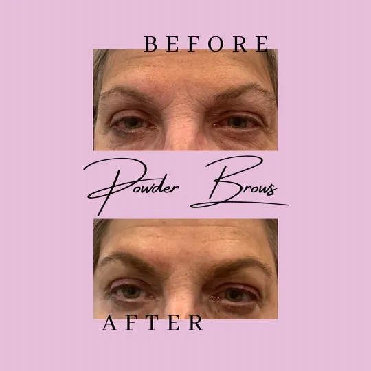 Esthetics By Elayna Picture 5