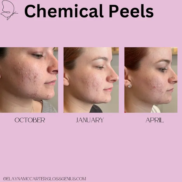 Esthetics By Elayna Picture 9