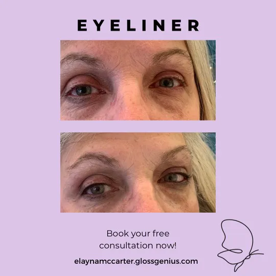 Esthetics By Elayna Picture 3