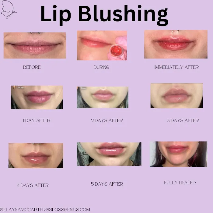 Esthetics By Elayna Picture 8