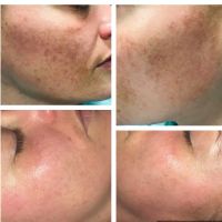 Skin Care Essentials ico