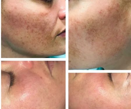 Skin Care Essentials