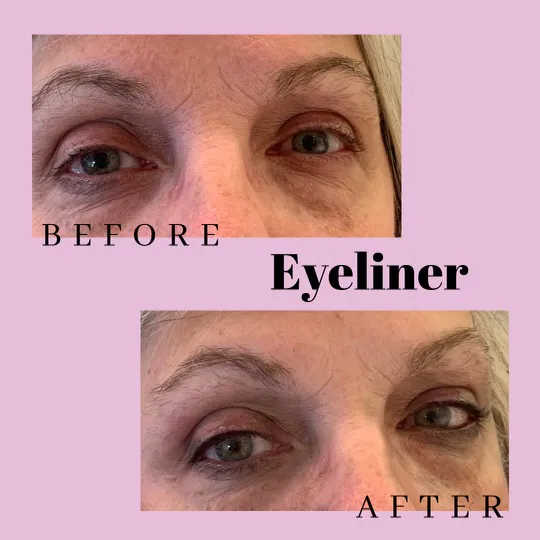 Esthetics By Elayna Picture 9