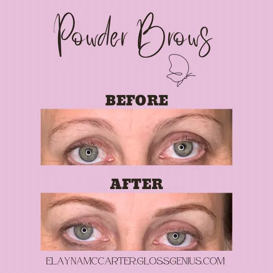 Esthetics By Elayna Picture 3