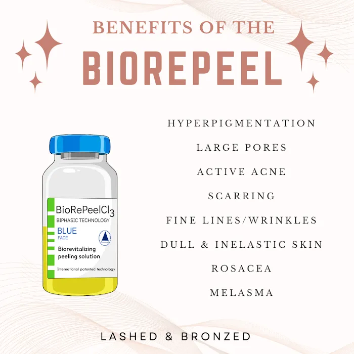 SKN Redone Picture 5