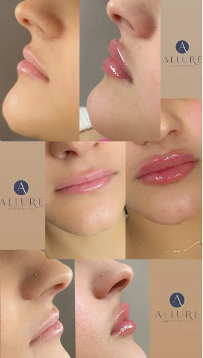 Allure Aesthetics Picture 2