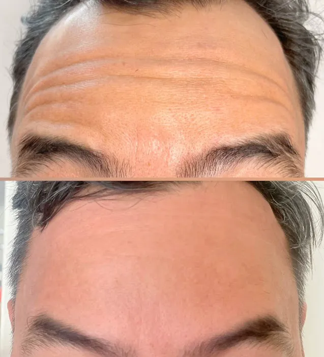 Allure Aesthetics Picture 4