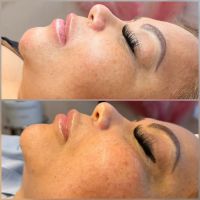 Allure Aesthetics ico