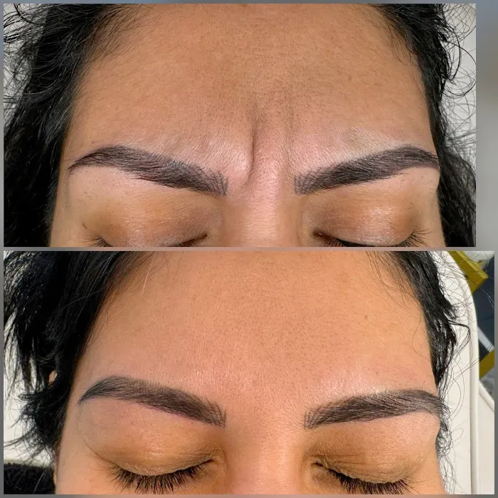 Allure Aesthetics Picture 7