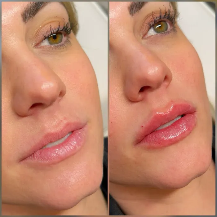 Allure Aesthetics Picture 6