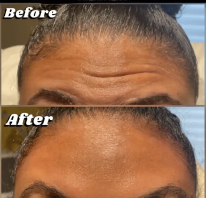 Allure Aesthetics Picture 10