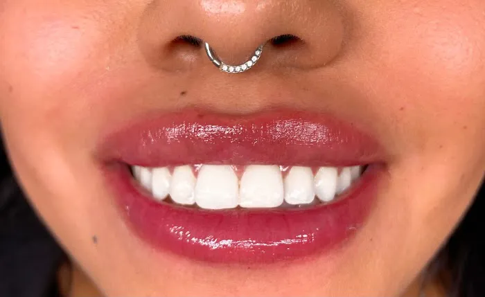 Allure Aesthetics Picture 9