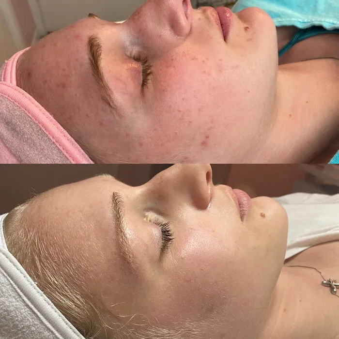 Skincare by Emilia Picture 6