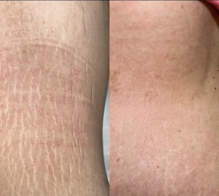 Unmarked Aesthetics Picture 4