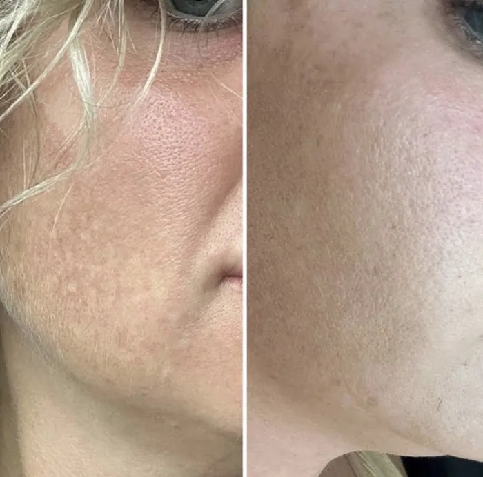 Amery Aesthetics Picture 3