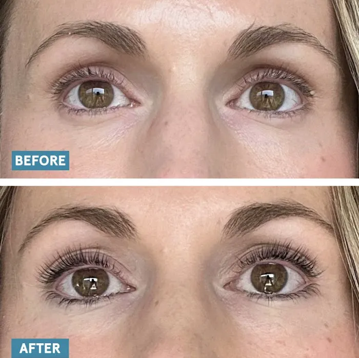 Amery Aesthetics Picture 4