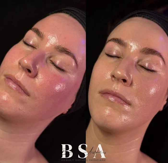 Bare Skin Aesthetics Picture 1