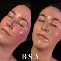 Bare Skin Aesthetics ico