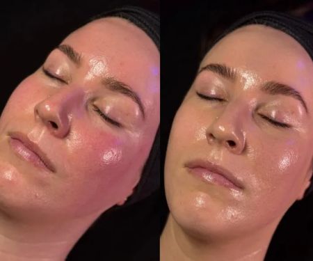 Bare Skin Aesthetics