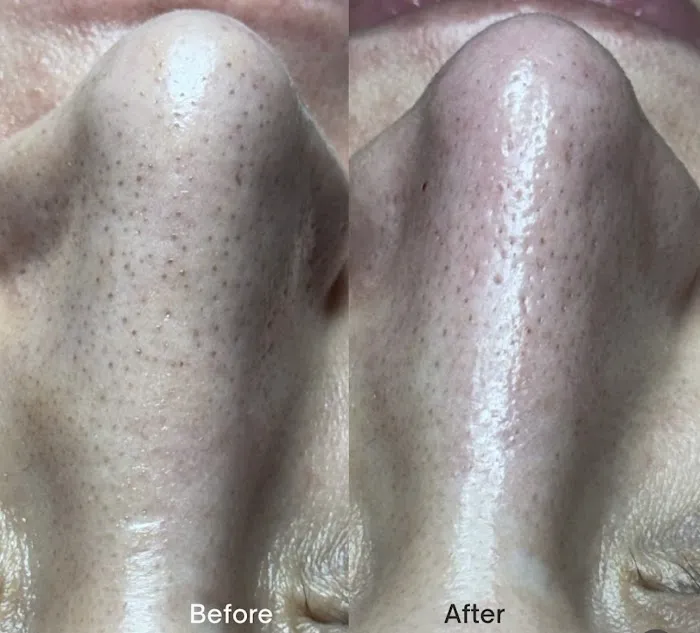 Bare Skin Aesthetics Picture 6