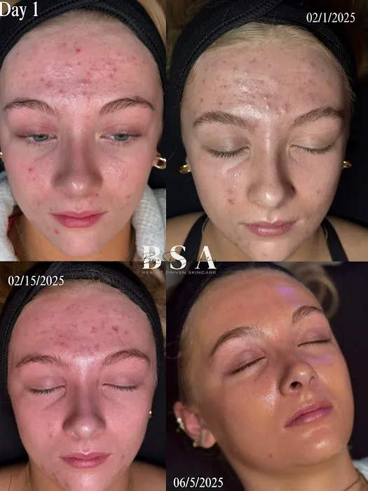 Bare Skin Aesthetics Picture 2