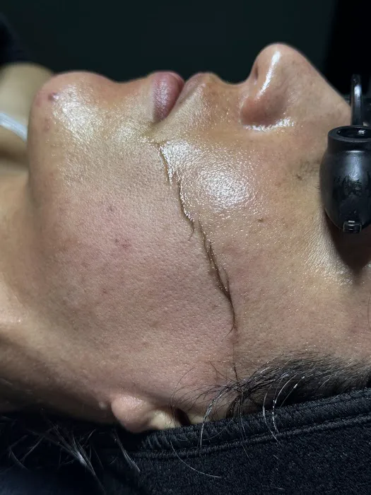 Bare Skin Aesthetics Picture 5