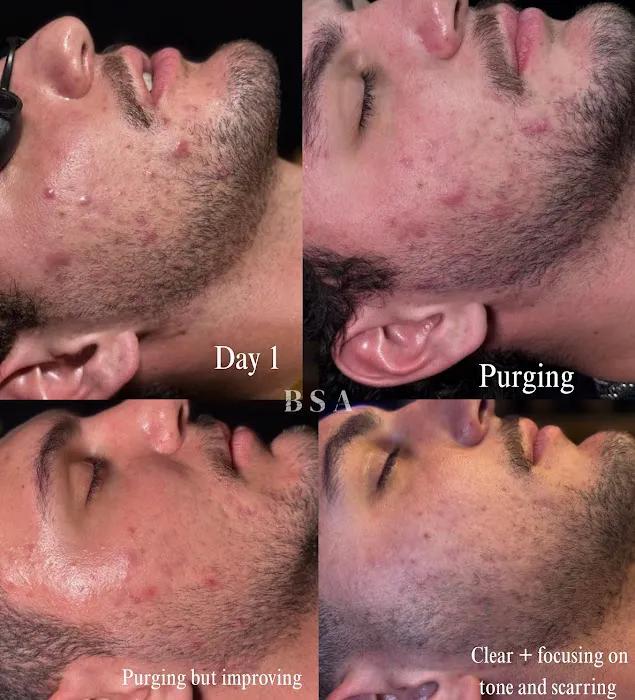 Bare Skin Aesthetics Picture 7