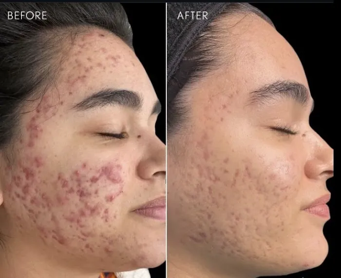 Bare Skin Aesthetics Picture 8