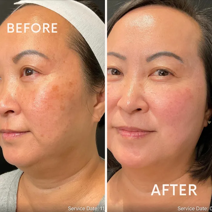 Bare Skin Aesthetics Picture 10