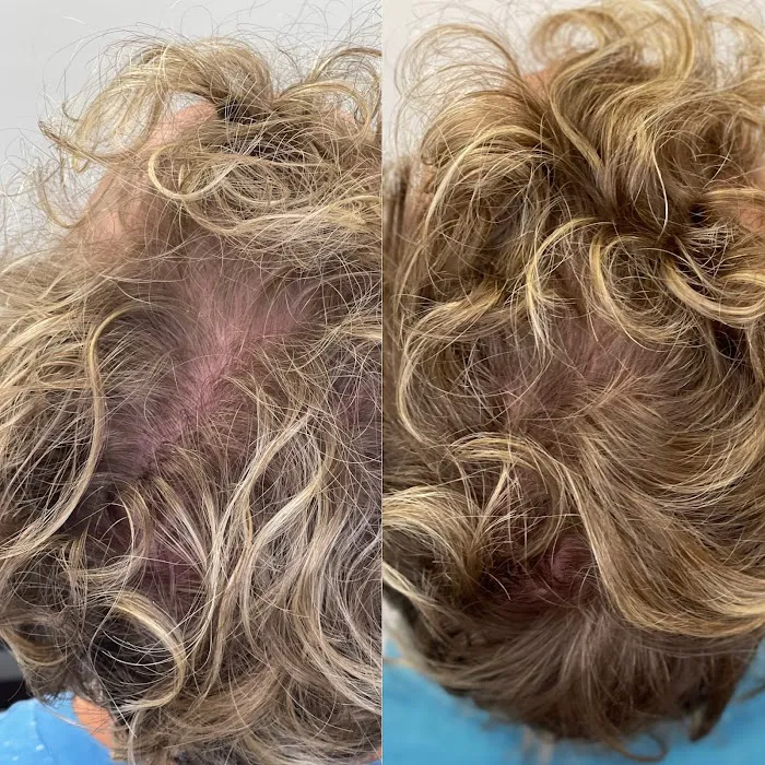 CARE Esthetics Picture 2