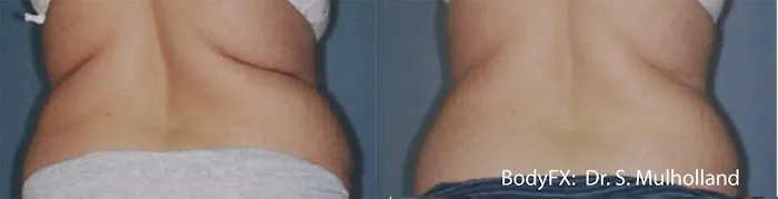 You Living Younger, LLC Picture 1