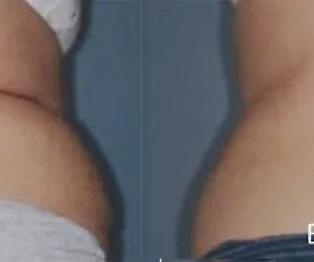 You Living Younger, LLC