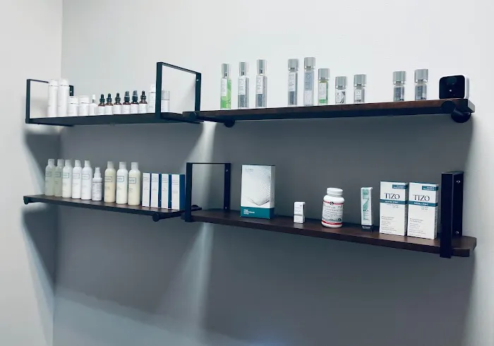 Apeeling Skin Picture 1