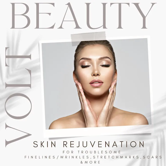 Volt Beauty Picture 4