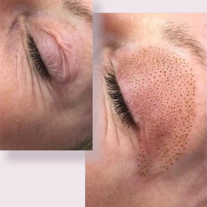 Volt Beauty Picture 3